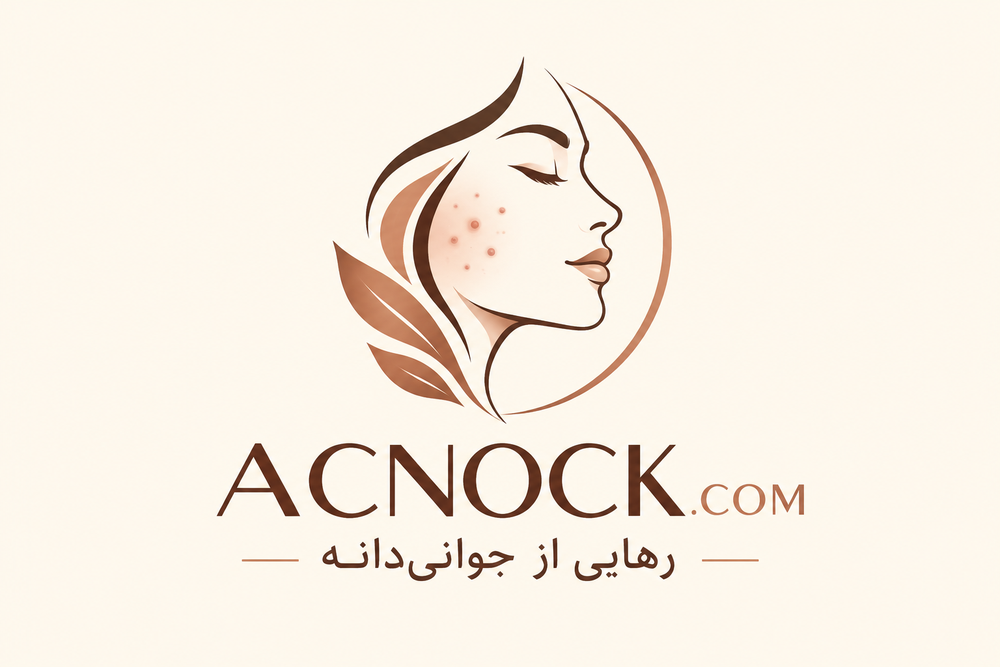 ACNOCK
